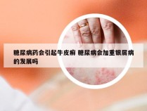 糖尿病药会引起牛皮癣 糖尿病会加重银屑病的发展吗