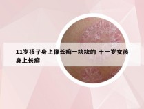 11岁孩子身上像长癣一块块的 十一岁女孩身上长癣