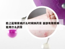 脸上起银屑病什么时候抹药膏 面部有银屑病能用什么药膏