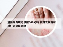 进展期白斑可以照308光吗 白斑发展期可以打新冠疫苗吗