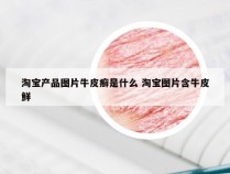 淘宝产品图片牛皮癣是什么 淘宝图片含牛皮鲜