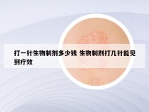 打一针生物制剂多少钱 生物制剂打几针能见到疗效