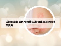 成都银康银屑医院收费 成都银康银屑医院收费贵吗