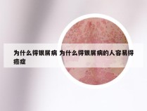 为什么得银屑病 为什么得银屑病的人容易得癌症