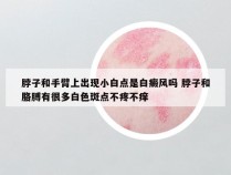 脖子和手臂上出现小白点是白癜风吗 脖子和胳膊有很多白色斑点不疼不痒