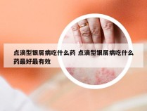 点滴型银屑病吃什么药 点滴型银屑病吃什么药最好最有效