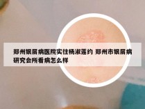 郑州银屑病医院实往杨淑莲约 郑州市银屑病研究会所看病怎么样