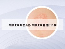 牛脸上长癣怎么办 牛脸上长包是什么病