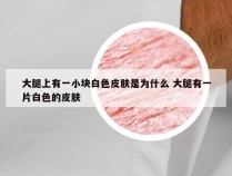 大腿上有一小块白色皮肤是为什么 大腿有一片白色的皮肤