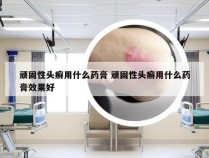 顽固性头癣用什么药膏 顽固性头癣用什么药膏效果好