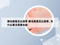 腋毛癣是怎么回事 腋毛癣是怎么回事, 为什么要注意腋毛癣