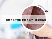 后脑勺长了块癣 后脑勺长了一块癣怎么办