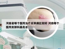 河南省哪个医院治疗皮肤病比较好 河南哪个医院皮肤科最出名