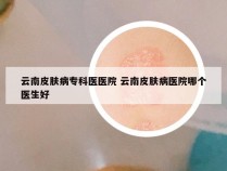 云南皮肤病专科医医院 云南皮肤病医院哪个医生好