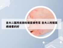 吉大二医院皮肤科银屑病专家 吉大二院银屑病谁看的好