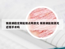 银屑病稳定期能做点阵激光 银屑病能做激光近视手术吗