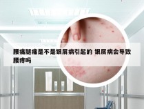 腰痛腿痛是不是银屑病引起的 银屑病会导致腰疼吗