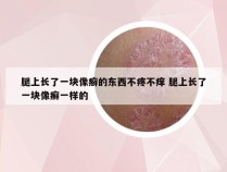 腿上长了一块像癣的东西不疼不痒 腿上长了一块像癣一样的