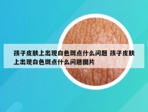 孩子皮肤上出现白色斑点什么问题 孩子皮肤上出现白色斑点什么问题图片