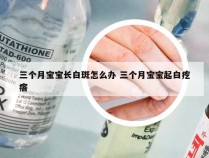 三个月宝宝长白斑怎么办 三个月宝宝起白疙瘩