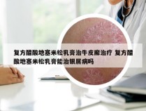 复方醋酸地塞米松乳膏治牛皮廨治疗 复方醋酸地塞米松乳膏能治银屑病吗