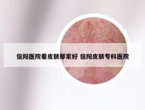 信阳医院看皮肤那家好 信阳皮肤专科医院