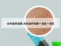 火针治疗白斑 火针治疗白斑一次比一次红