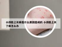 小孩脸上长癣是什么原因造成的 小孩脸上长了癣怎么办