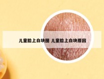 儿童脸上白块图 儿童脸上白块原因