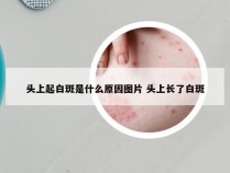 头上起白斑是什么原因图片 头上长了白斑