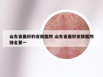 山东省最好的皮肤医院 山东省最好皮肤医院排名第一