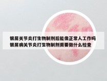 银屑关节炎打生物制剂后能像正常人工作吗 银屑病关节炎打生物制剂需要做什么检查