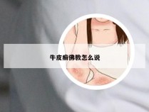 牛皮癣佛教怎么说