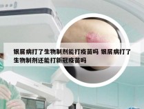 银屑病打了生物制剂能打疫苗吗 银屑病打了生物制剂还能打新冠疫苗吗