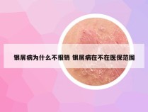 银屑病为什么不报销 银屑病在不在医保范围