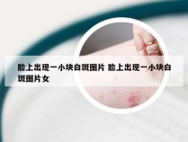 脸上出现一小块白斑图片 脸上出现一小块白斑图片女