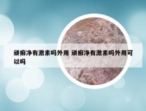 顽癣净有激素吗外用 顽癣净有激素吗外用可以吗