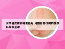 河南省皮肤科哪里最好 河南省最权威的皮肤科专家是谁