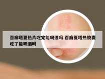 百癣塔夏热片吃完能喝酒吗 百癣夏塔热胶囊吃了能喝酒吗