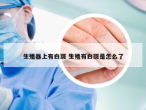 生殖器上有白斑 生殖有白斑是怎么了