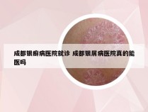 成都银癣病医院就诊 成都银屑病医院真的能医吗