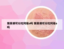 银屑病可以吃阿维a吗 银屑病可以吃阿维a吗