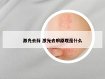 激光去藓 激光去癣原理是什么