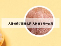 人体长癣了擦什么药 人长癣了用什么药