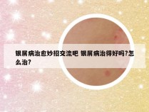 银屑病治愈妙招交流吧 银屑病治得好吗?怎么治?