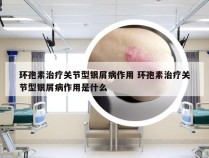 环孢素治疗关节型银屑病作用 环孢素治疗关节型银屑病作用是什么