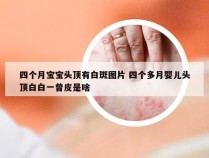 四个月宝宝头顶有白斑图片 四个多月婴儿头顶白白一曾皮是啥