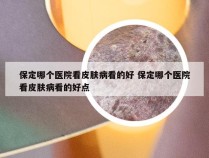 保定哪个医院看皮肤病看的好 保定哪个医院看皮肤病看的好点