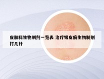 皮肤科生物制剂一览表 治疗银皮癣生物制剂打几针