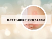 脸上有个小白斑图片 脸上有个小白色点